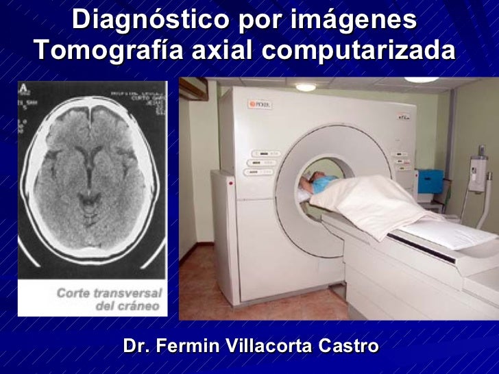 tomografia axial computarizada